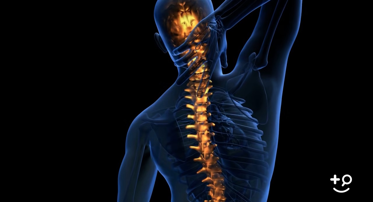 Spinal Nerve Surgery Overview Doctorpedia