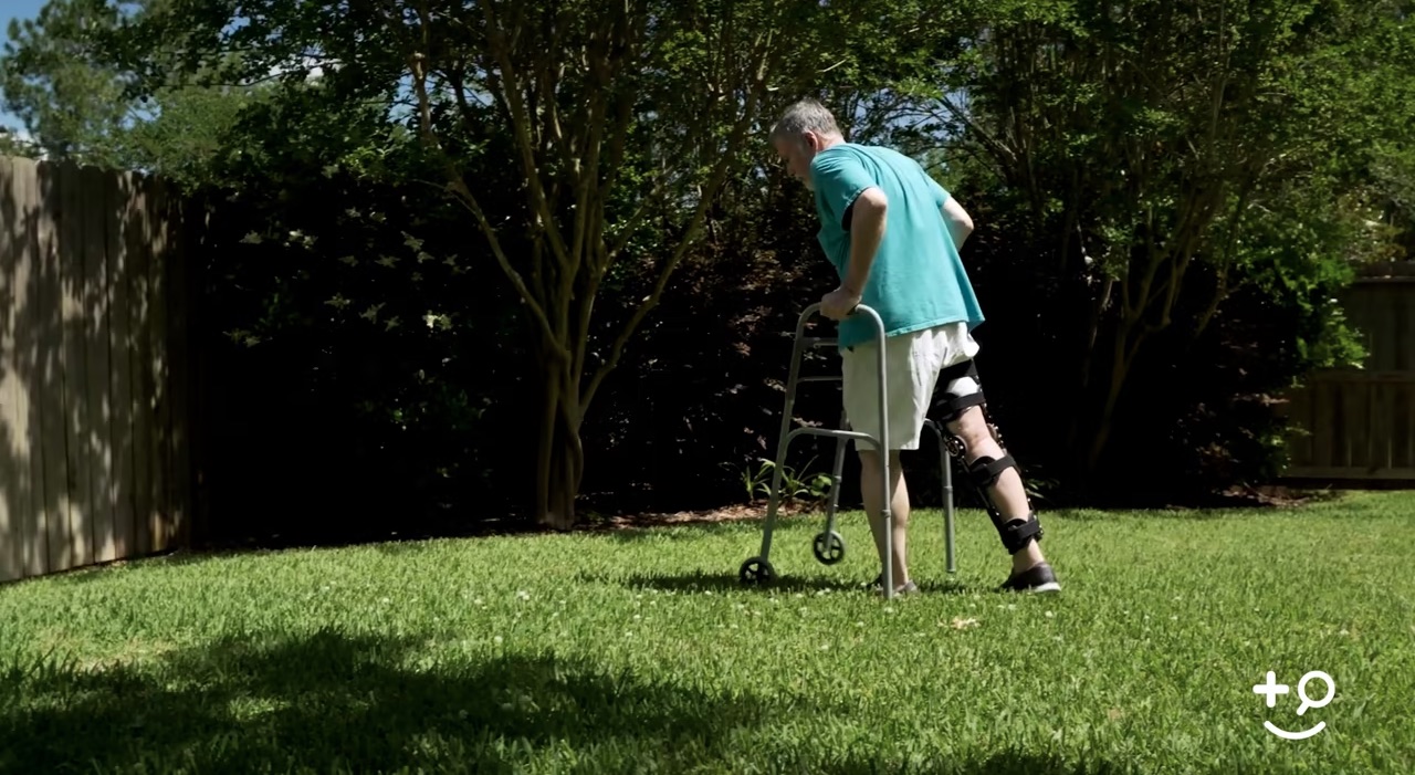 Psoriatic Arthritis Medical Devices Doctorpedia DoctorReviewed Video