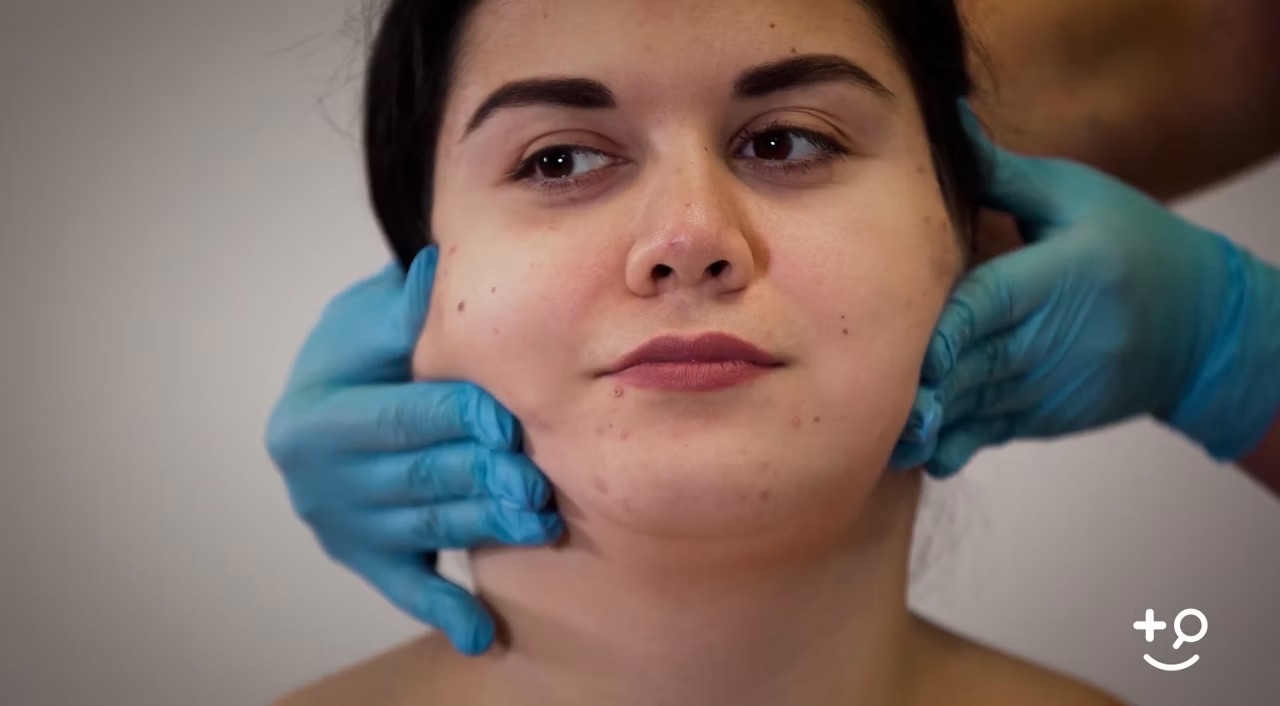 Chin Surgery Will I have Scars? Doctorpedia DoctorReviewed Video